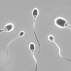 Testicular Sperm Extraction (TESE)