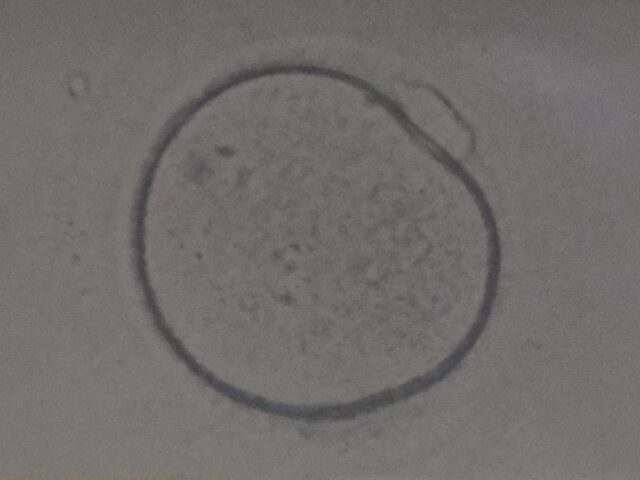 https://tradhospitalfertilitycenter.com/wp-content/uploads/2025/02/WhatsApp-Image-2025-02-21-at-1.52.44-PM-640x480.jpeg